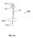 Fig. 52 - Bodily Fluid Sample Collection and Transport