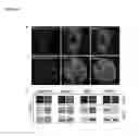 Fig. 03 - FLUORESCENT TWO-HYBRID (F2H) ASSAY FOR DIRECT VISUALIZATION OF PROTEIN INTERACTIONS IN LIVING CELLS