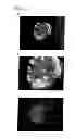 Fig. 05 - Islet Cells From Human Embryonic Stem Cells