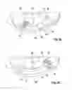 Fig. 03 - Protective hood device