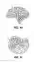 Fig. 07 - Exercise device
