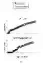 Fig. 02 - DIAGNOSIS OF SYSTEMIC LUPUS ERYTHEMATOSUS