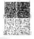 Fig. 09 - Method for using permuted nucleic acid probes