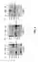 Fig. 05 - Compounds for inhibition of MMP13-substrate interactions and methods of use thereof to treat osteoarthritis and cartilage degeneration