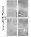 Fig. 40 - Compounds for inhibition of MMP13-substrate interactions and methods of use thereof to treat osteoarthritis and cartilage degeneration