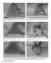 Fig. 09 - Methods of treating oral mucositis