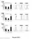 Fig. 14 - Methods of Diagnosing and Treating Multiple Sclerosis