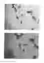 Fig. 03 - Ropinirole-containing adhesive patch