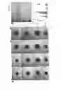 Fig. 08 - Method for reducing expression of downregulated in renal cell carcinoma in malignant gliomas