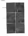 Fig. 27 - Method for reducing expression of downregulated in renal cell carcinoma in malignant gliomas