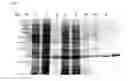 Fig. 02 - Recombinant bacteria recognizing protein and uses thereof
