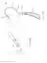 Fig. 19 - Sacrocolpopexy support