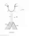 Fig. 35 - Sacrocolpopexy support