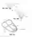 Fig. 16 - Therapeutic methods and devices following myocardial infarction
