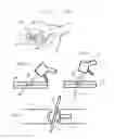 Fig. 03 - Rapid laparoscopy exchange system and method of use thereof