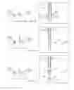 Fig. 07 - Rapid laparoscopy exchange system and method of use thereof
