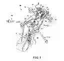 Fig. 02 - Surgical access system and related methods