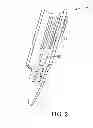 Fig. 03 - Surgical access system and related methods