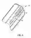 Fig. 07 - Surgical access system and related methods