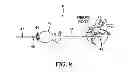 Fig. 10 - Surgical access system and related methods