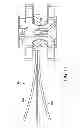 Fig. 12 - Surgical access system and related methods