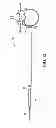 Fig. 13 - Surgical access system and related methods