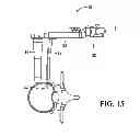 Fig. 16 - Surgical access system and related methods
