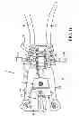 Fig. 17 - Surgical access system and related methods