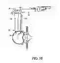 Fig. 19 - Surgical access system and related methods