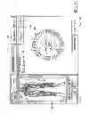 Fig. 22 - Surgical access system and related methods