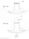 Fig. 03 - Apparatus and method for removing a foreign object from a rectal cavity