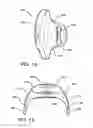 Fig. 14 - METHOD AND APPARATUS FOR PROVIDING DERVIED GLUCOSE INFORMATION UTILIZING PHYSIOLOGICAL AND/OR CONTEXTUAL PARAMETERS