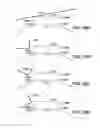 Fig. 33 - METHOD AND APPARATUS FOR PROVIDING DERVIED GLUCOSE INFORMATION UTILIZING PHYSIOLOGICAL AND/OR CONTEXTUAL PARAMETERS