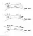 Fig. 34 - METHOD AND APPARATUS FOR PROVIDING DERVIED GLUCOSE INFORMATION UTILIZING PHYSIOLOGICAL AND/OR CONTEXTUAL PARAMETERS