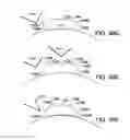 Fig. 35 - METHOD AND APPARATUS FOR PROVIDING DERVIED GLUCOSE INFORMATION UTILIZING PHYSIOLOGICAL AND/OR CONTEXTUAL PARAMETERS