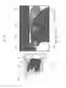 Fig. 24 - Oral cavity sensor