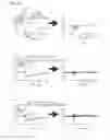 Fig. 27 - Oral cavity sensor