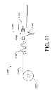 Fig. 25 - CONTINUOUS ANALYTE SENSORS AND METHODS OF MAKING SAME