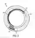 Fig. 04 - Ophthalmic lens with a microfluidic system