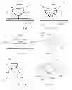 Fig. 05 - Object, method, and system for detecting heartbeat or whether or not electrodes are in proper contact