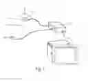 Fig. 02 - SYSTEM AND METHOD FOR PROVIDING MAGNETIC BASED NAVIGATION SYSTEM IN DENTAL IMPLANT SURGERY