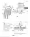 Fig. 02 - Diagnosis of swallowing disorders using high resolution manometry