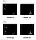 Fig. 07 - SYSTEM AND METHOD FOR ELECTROMECHANICAL WAVE IMAGING OF BODY STRUCTURES
