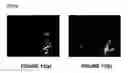 Fig. 09 - SYSTEM AND METHOD FOR ELECTROMECHANICAL WAVE IMAGING OF BODY STRUCTURES