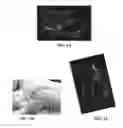 Fig. 02 - ENHANCED ULTRASOUND IMAGING INTERPRETATION AND NAVIGATION