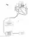 Fig. 02 - Enhanced activation onset time optimization by similarity based pattern matching
