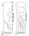 Fig. 04 - Model-based method for assessing acoustic signal quality in heart monitoring device
