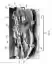 Fig. 08 - MOBILE GAIT FORCE AND MOTION ANALYSIS SYSTEM