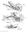 Fig. 06 - Surgical cast venting device and material