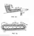 Fig. 07 - Surgical cast venting device and material